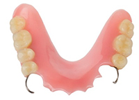 歯科 部分入れ歯の種類