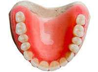入れ歯のレジン床義歯